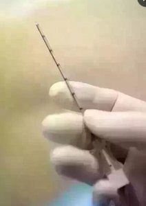 ​男人们了解女人剖腹产用麻醉针头有多粗吗,辛苦了!