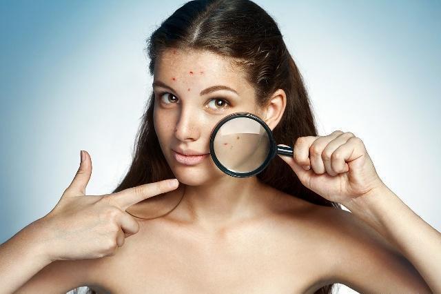 护肤品致痘成分大盘点,长痘的最大“元凶”到底是谁?