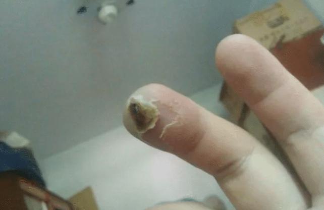 土公蛇到底是不是剧毒蛇?它和眼镜蛇相比谁的毒性更大?