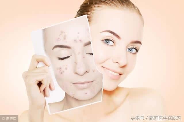 女生胸口长红色痘痘怎么回事（胸前长痘痘是什么原因）