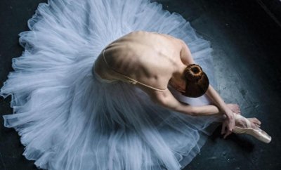 ​芭蕾舞者的美丽与艰辛 足部变形严重