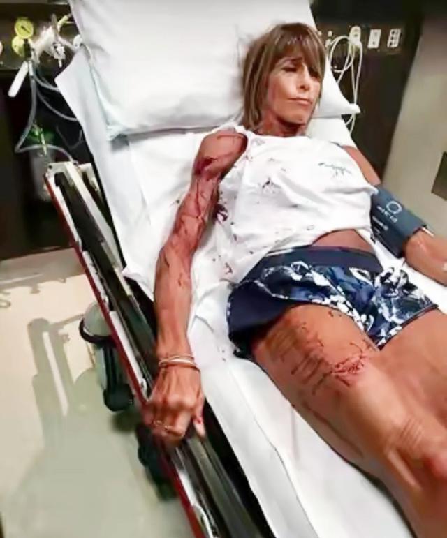 牧羊犬扑咬（袋鼠打趴拳手让女教练装死）(8)