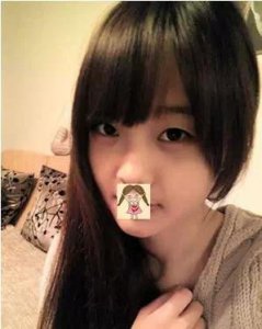 ​埋线双眼皮两个月晒图，大家看看恢复咋样？