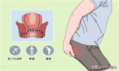 ​肛瘘患者：“不想治了，我真的太痛了！”肛瘘手术到底有多痛？