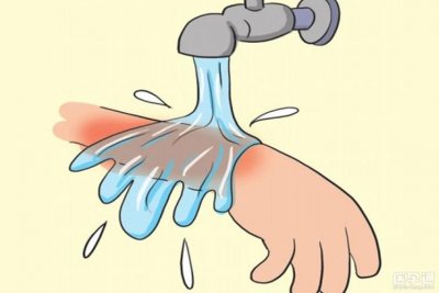 ​烫伤用什么方法好的最快（烫伤怎么办）