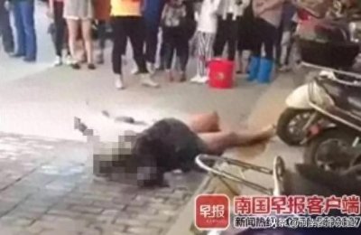 ​广西一孕妇当街被人点火烧伤！所幸经抢救，双胞胎女婴平安出生！